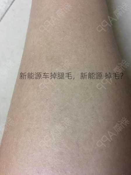 新能源车掉腿毛，新能源 掉毛？